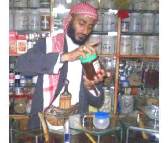 الغش يهدد سمعة العسل اليمني العالمية
