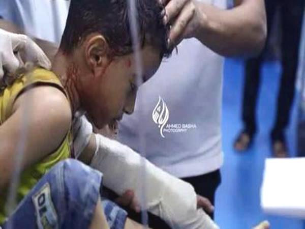 "لا تقبروناش"...آخر صرخات طفل اليمن