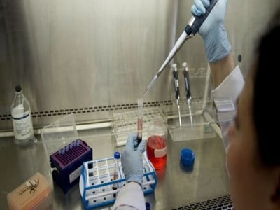 دراسة: اختبار للدم يمكن أن يكشف مبكرا عن الإصابة بالزهايمر