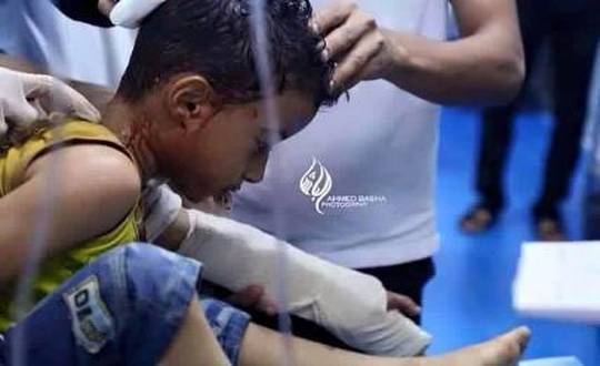 مقتل 1277 مدنيا بتعز ونزوح قرابة 10 الاف أسرة منذ بداية الحرب