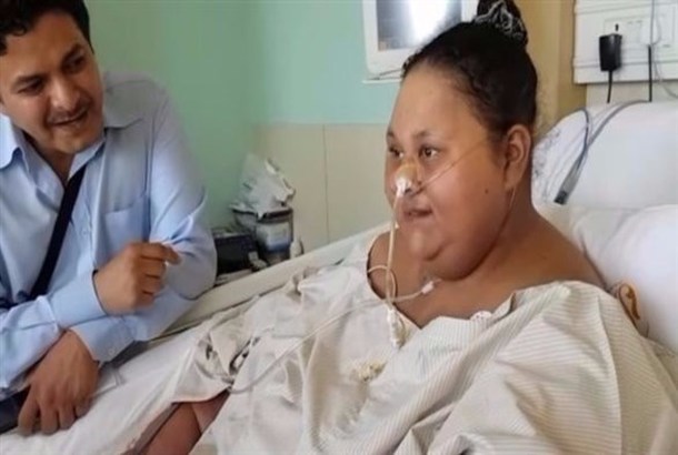 جراحة ناجحة تفقد مصرية 250 كيلوغراماً من وزنها خلال شهرين