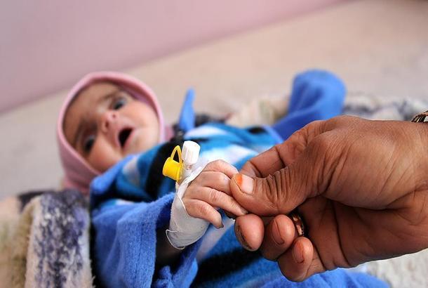 الأمم المتحدة: قرابة مليون إصابة بوباء الكوليرا في اليمن