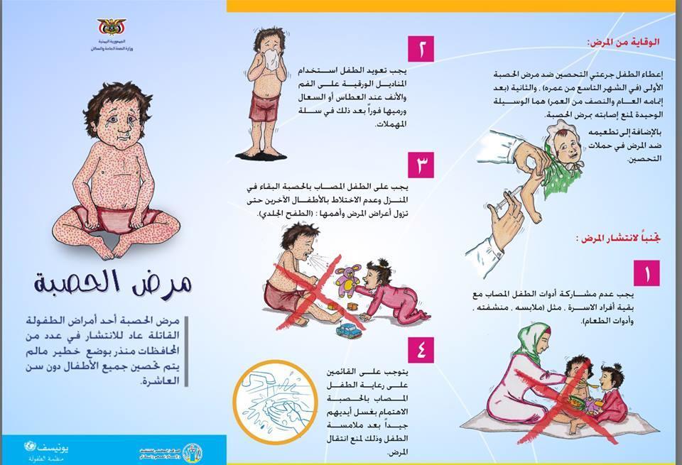 الإعلان عن ثلاث وفيات بسبب مرض الحصبة في البيضاء