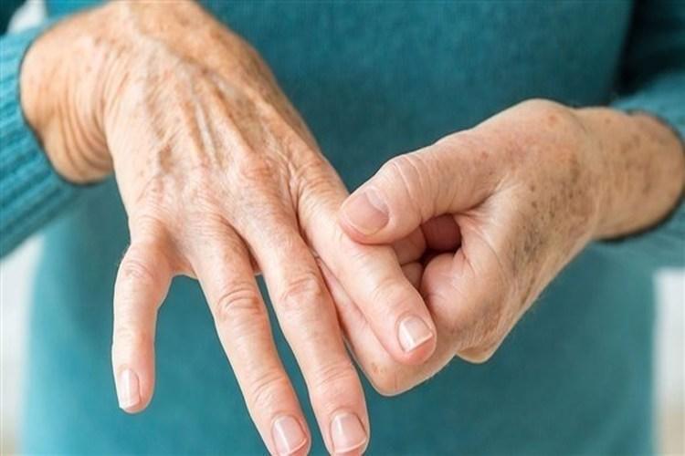 أعراض تنذر بالتهاب المفاصل الروماتويدي.. تعرف عليها