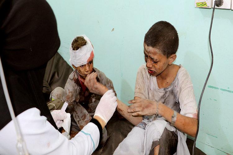 التحالف يقر بوقوع خطأ خلال استهداف أطفال في ضحيان بصعدة
