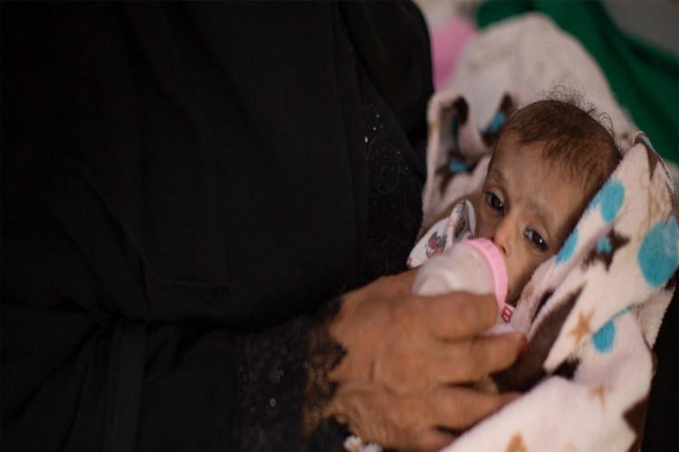 اليونيسف: اليمن جحيم حي وطفل يموت كل 10 دقائق