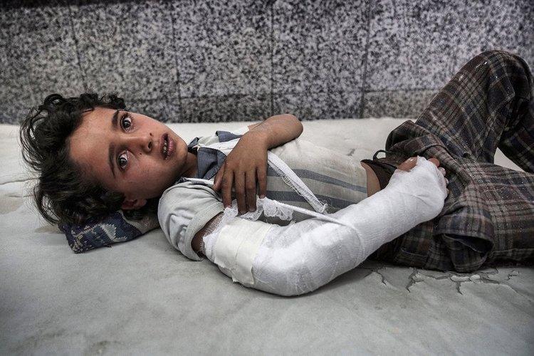 الأمم المتحدة: نتابع بقلق تفجير صنعاء الذي أدى مقتل وإصابة مدنيين