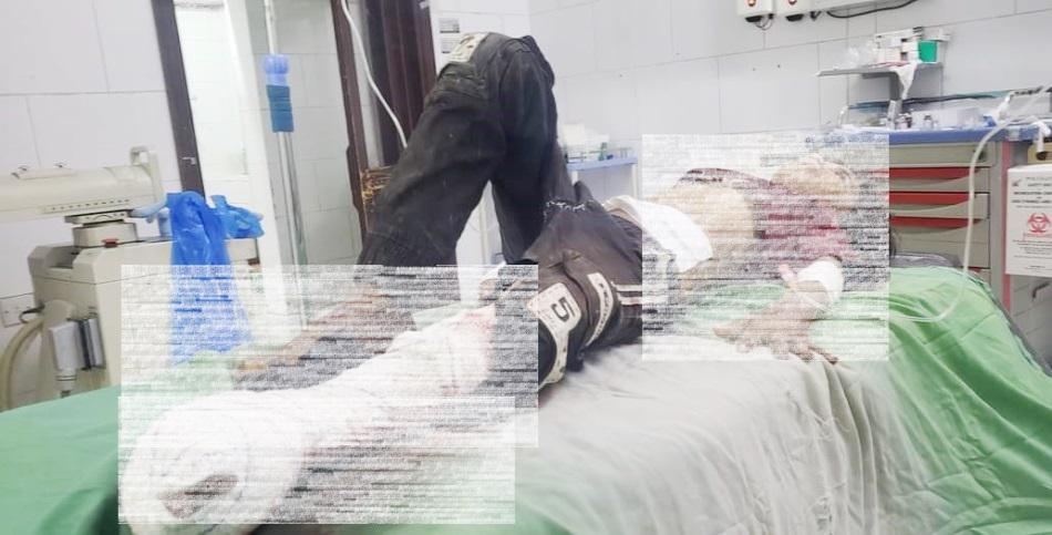 شهيد وجرحى مدنيون أغلبهم أطفال بنيران الحوثيين في تعز